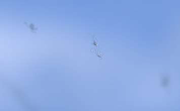 Plutajuće čestice u očima - uzroci, simptomi i liječenje