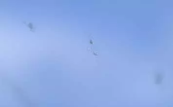 Plutajuće čestice u očima - uzroci, simptomi i liječenje