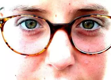 Kako se riješiti kratkovidnosti, dalekovidnosti i astigmatizma?