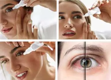 “Nano – kapi” – kapi koje popravljaju vid