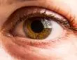 Svrbe vas oči - što su očne alergije i na što sve možete biti alergični?