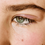 https://dioptrija.hr/zdravlje/ubod-komarca-zatvorio-vam-je-oko-evo-sto-stvarno-pomaze
