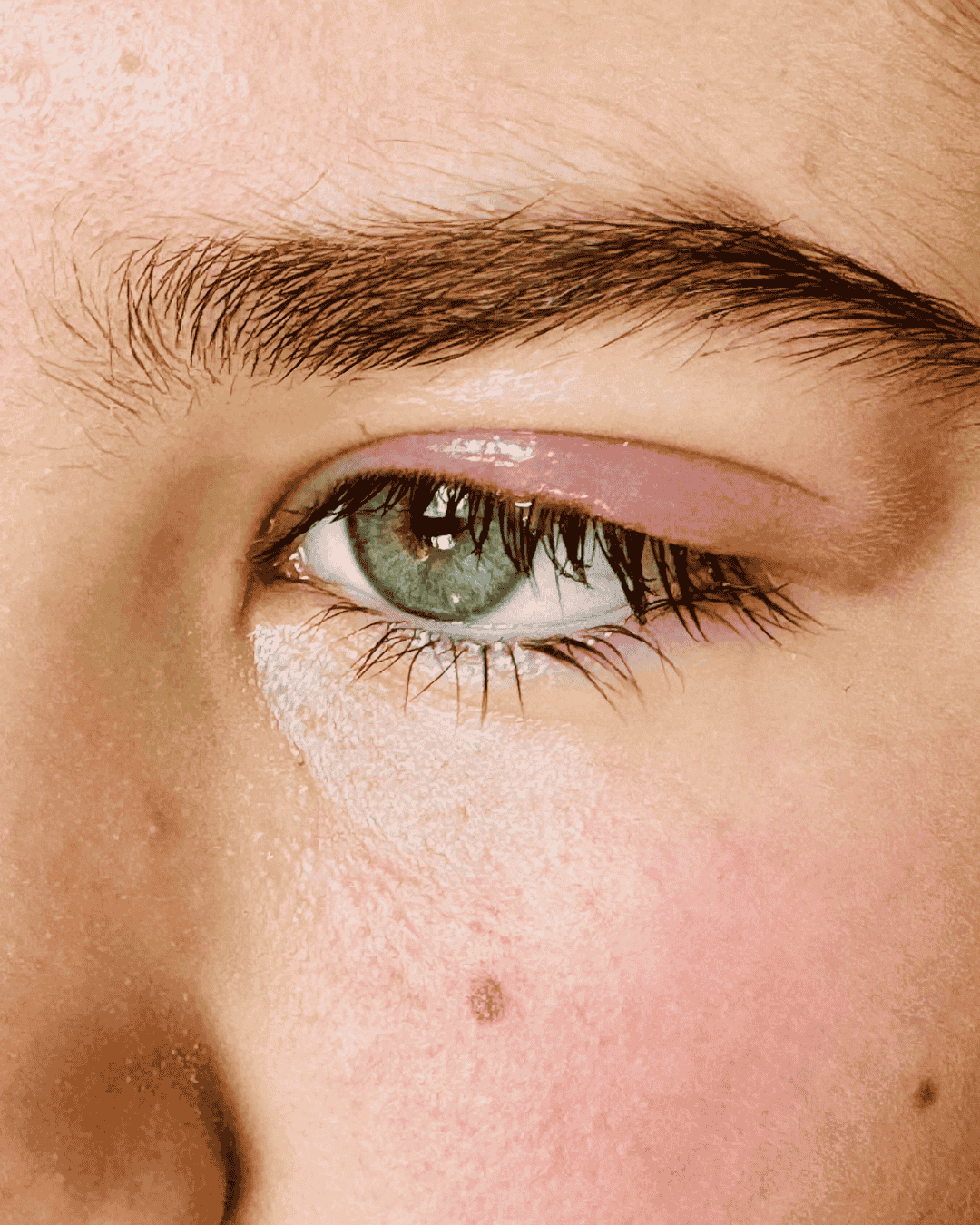 Ubod komarca vam je zatvorio oko? Evo što stvarno pomaže