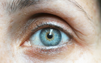 Ovo su 4 skrivena simptoma glaukoma, evo što trebate znati!