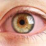 https://dioptrija.hr/zdravlje/crvene-oci-ujutro-normalno-ili-znak-problema