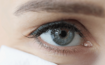 Natečeni kapci ujutro: zašto se budimo s otečenim očima i kako to spriječiti