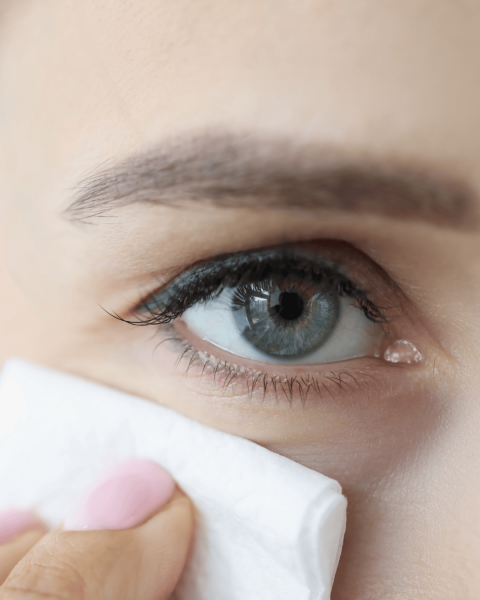 Nateceni kapci uzroci